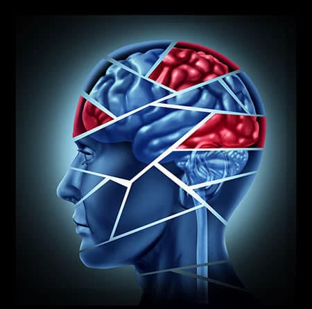traumatic brain injury