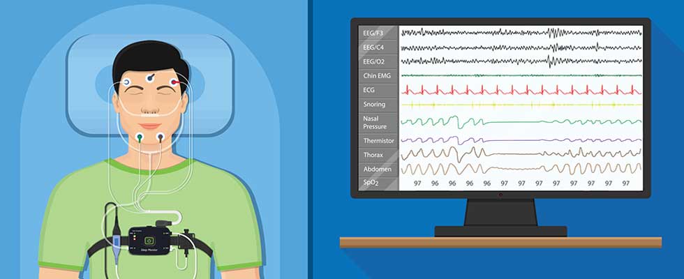 Billing for Polysomnography Services