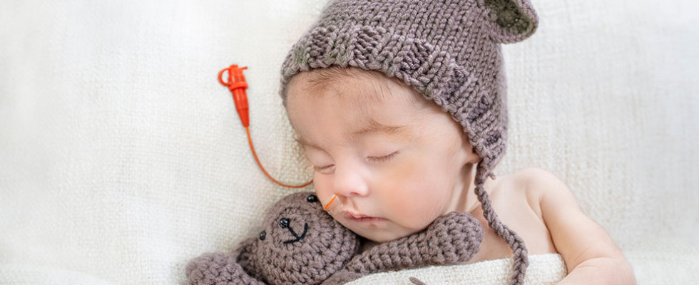 A sleeping infant with a feeding tube in its nose 