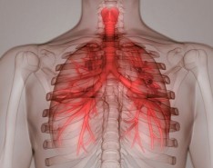 How to Lower Hospital Readmissions Through Pulmonary Rehab