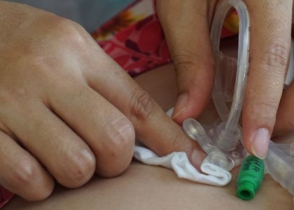 an image of someone getting enteral nutrition at home